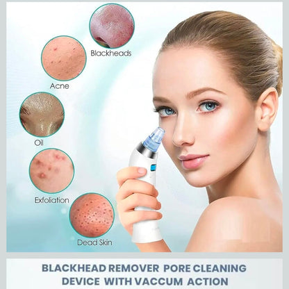 Derma Suction Blackhead Remover Tool – Electric Pore Vacuum Cleaner with 4 Suction Heads for Deep Facial Cleansing, Acne, Pimple & Oil Removal – USB Rechargeable